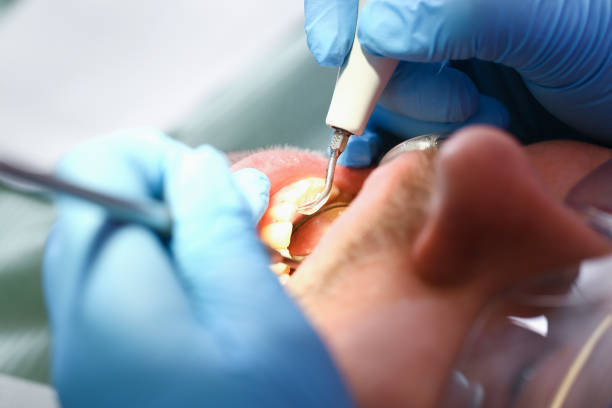 Best Emergency Orthodontic Repairs in Mississippi State, MS