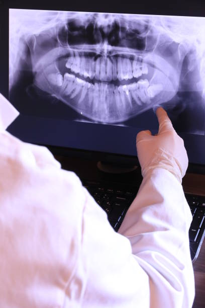 Best Emergency Treatment for Oral Infections in Mississippi State, MS
